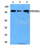 Anti-PIP5KIγ Antibody from Bioworld Technology (BS5857) - Antibodies.com