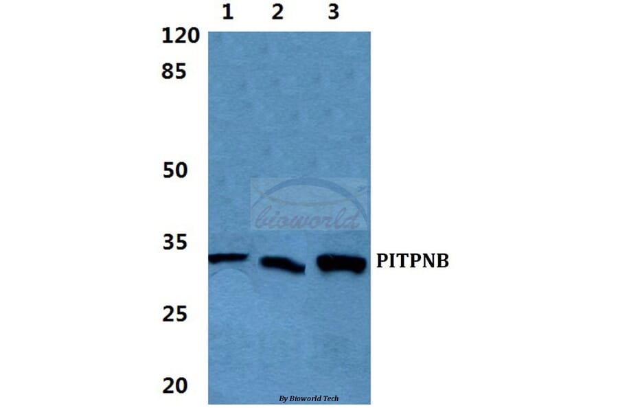 Anti-PITPNB Antibody from Bioworld Technology (BS5858) - Antibodies.com