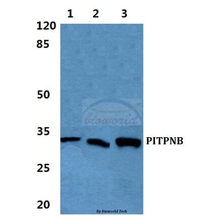 Anti-PITPNB Antibody from Bioworld Technology (BS5858) - Antibodies.com