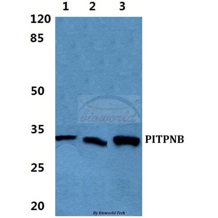 Anti-PITPNB Antibody from Bioworld Technology (BS5858) - Antibodies.com