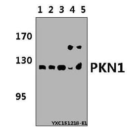 Anti-PKN1 Antibody from Bioworld Technology (BS5859) - Antibodies.com
