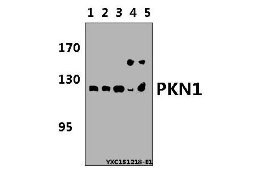 Anti-PKN1 Antibody from Bioworld Technology (BS5859) - Antibodies.com