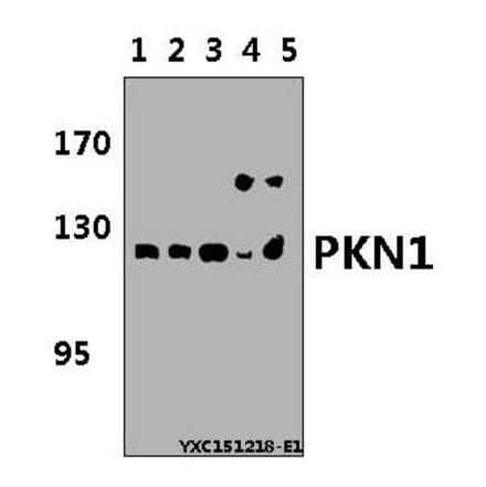 Anti-PKN1 Antibody from Bioworld Technology (BS5859) - Antibodies.com