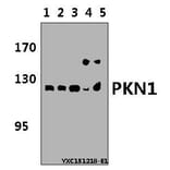 Anti-PKN1 Antibody from Bioworld Technology (BS5859) - Antibodies.com