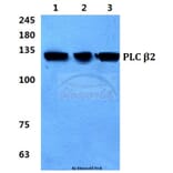 Anti-PLC β2 Antibody from Bioworld Technology (BS5860) - Antibodies.com