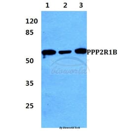 Anti-PPP2R1B Antibody from Bioworld Technology (BS5862) - Antibodies.com
