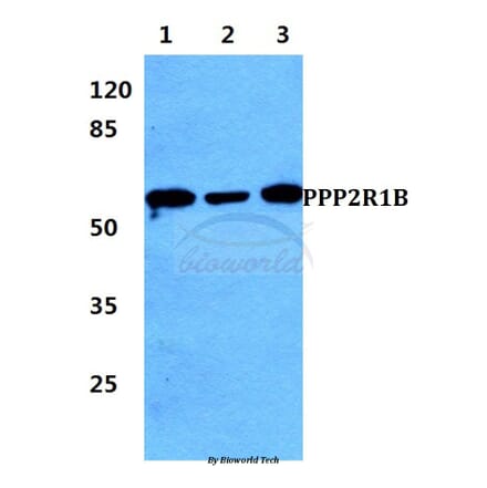 Anti-PPP2R1B Antibody from Bioworld Technology (BS5862) - Antibodies.com