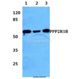 Anti-PPP2R1B Antibody from Bioworld Technology (BS5862) - Antibodies.com