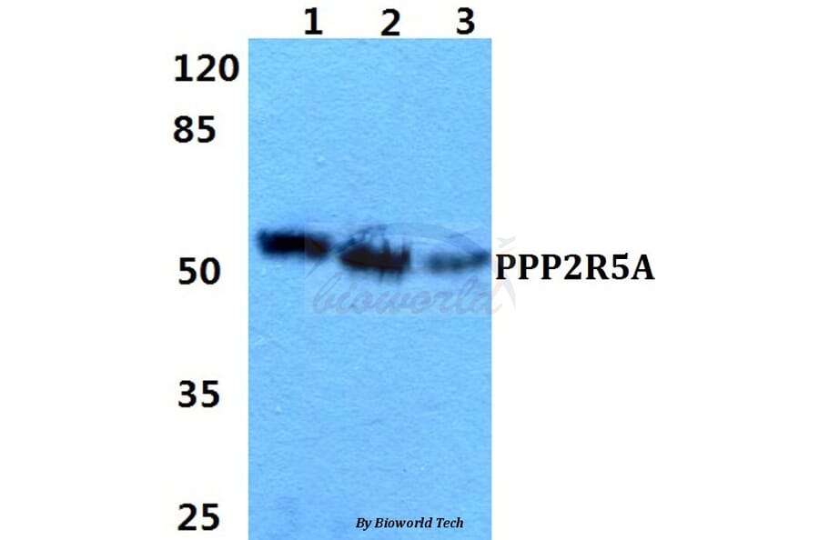 Anti-PPP2R5A Antibody from Bioworld Technology (BS5863) - Antibodies.com
