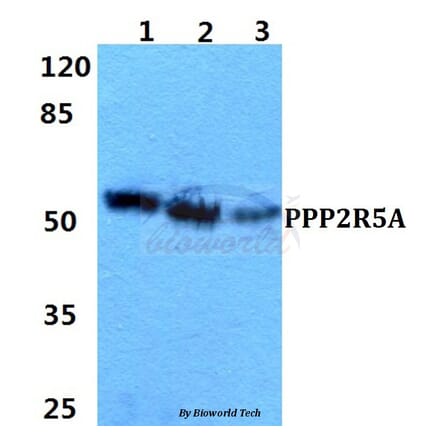Anti-PPP2R5A Antibody from Bioworld Technology (BS5863) - Antibodies.com