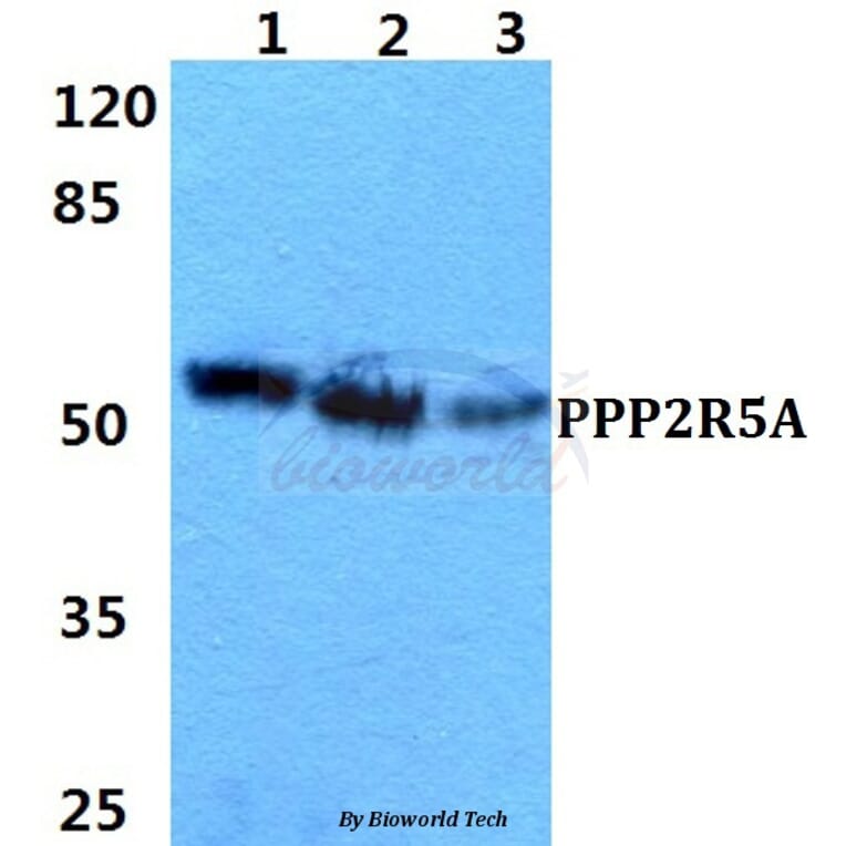 Anti-PPP2R5A Antibody from Bioworld Technology (BS5863) - Antibodies.com