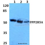 Anti-PPP2R5A Antibody from Bioworld Technology (BS5863) - Antibodies.com