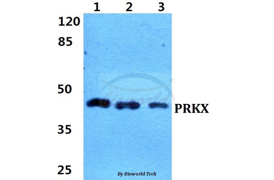 Anti-PRKX Antibody from Bioworld Technology (BS5865) - Antibodies.com