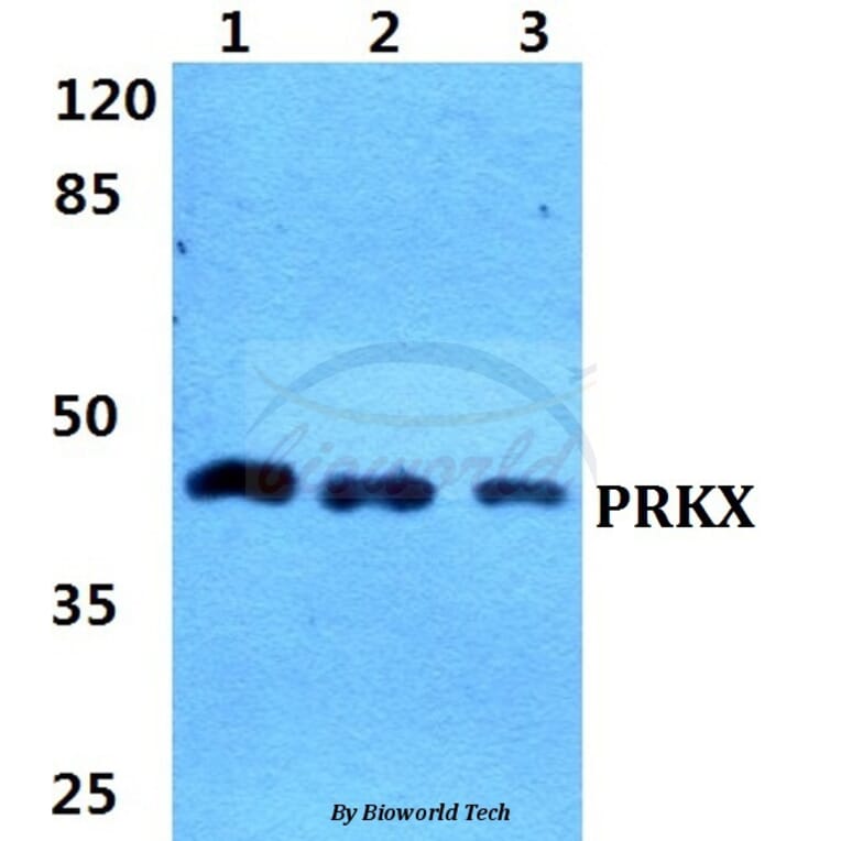 Anti-PRKX Antibody from Bioworld Technology (BS5865) - Antibodies.com