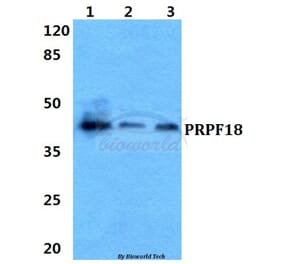 Anti-PRPF18 Antibody from Bioworld Technology (BS5866) - Antibodies.com