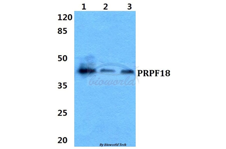 Anti-PRPF18 Antibody from Bioworld Technology (BS5866) - Antibodies.com