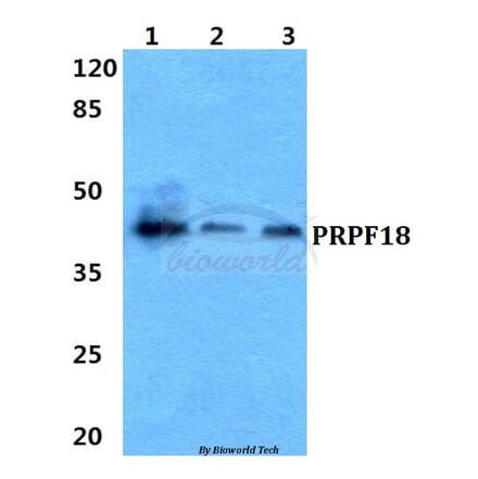 Anti-PRPF18 Antibody from Bioworld Technology (BS5866) - Antibodies.com