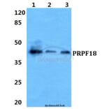 Anti-PRPF18 Antibody from Bioworld Technology (BS5866) - Antibodies.com
