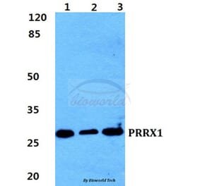 Anti-PRRX1 Antibody from Bioworld Technology (BS5867) - Antibodies.com