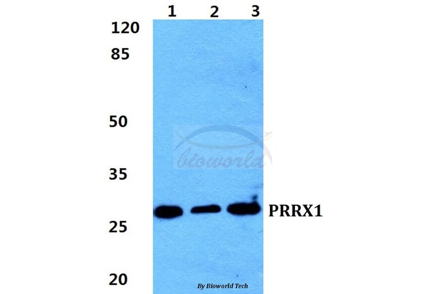 Anti-PRRX1 Antibody from Bioworld Technology (BS5867) - Antibodies.com