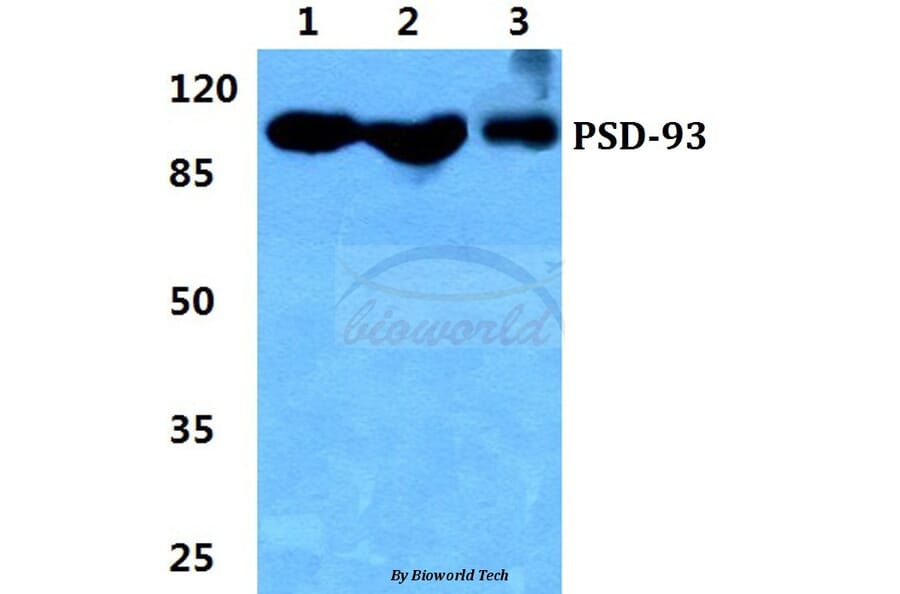 Anti-PSD-93 Antibody from Bioworld Technology (BS5868) - Antibodies.com