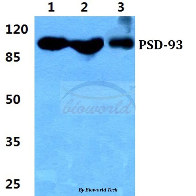 Anti-PSD-93 Antibody from Bioworld Technology (BS5868) - Antibodies.com
