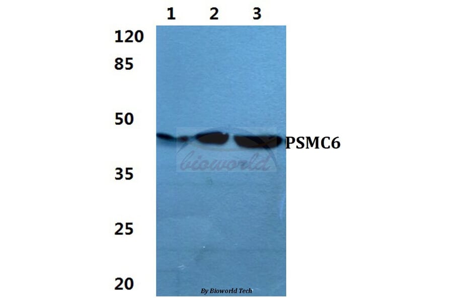 Anti-PSMC6 Antibody from Bioworld Technology (BS5869) - Antibodies.com