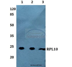 Anti-RPL10 Antibody from Bioworld Technology (BS5873) - Antibodies.com