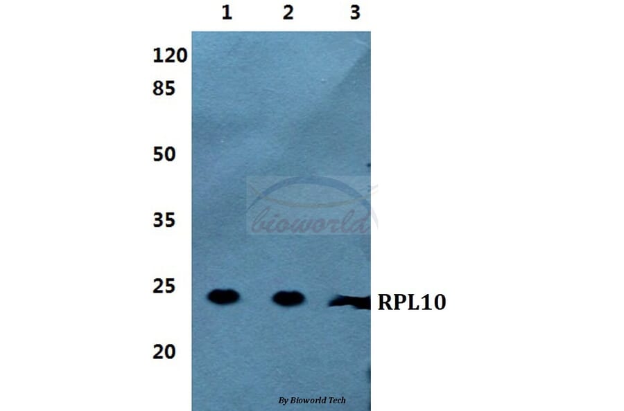 Anti-RPL10 Antibody from Bioworld Technology (BS5873) - Antibodies.com
