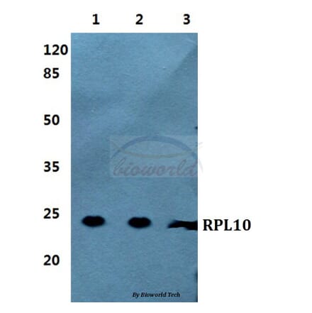 Anti-RPL10 Antibody from Bioworld Technology (BS5873) - Antibodies.com