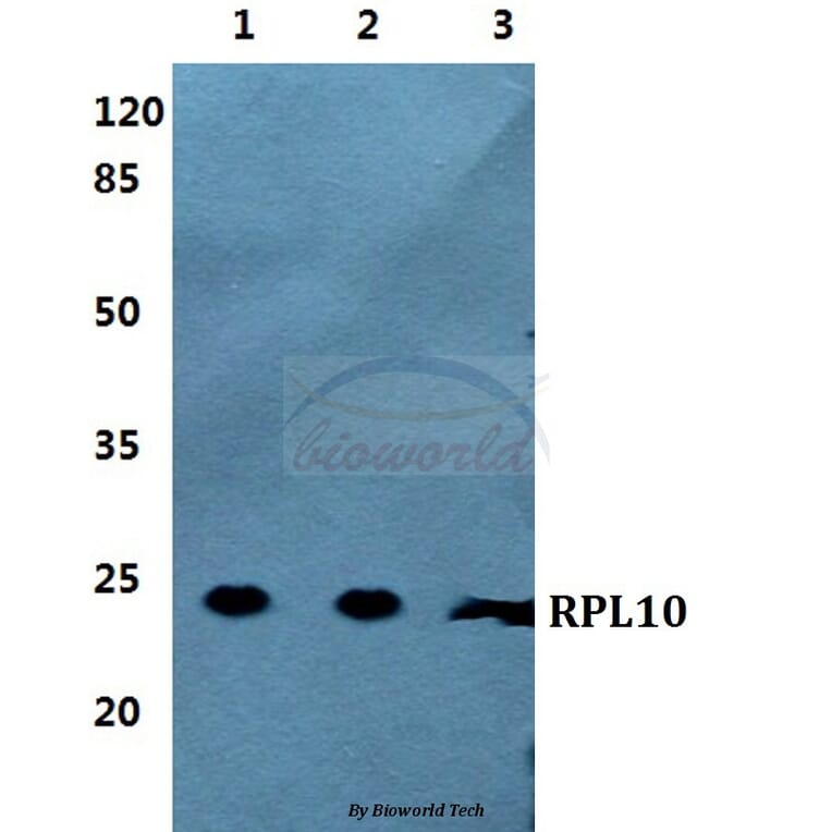 Anti-RPL10 Antibody from Bioworld Technology (BS5873) - Antibodies.com