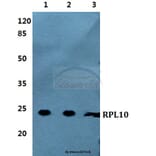 Anti-RPL10 Antibody from Bioworld Technology (BS5873) - Antibodies.com