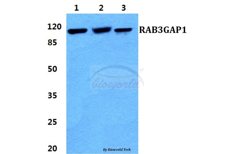 Anti-RAB3GAP1 Antibody from Bioworld Technology (BS5874) - Antibodies.com
