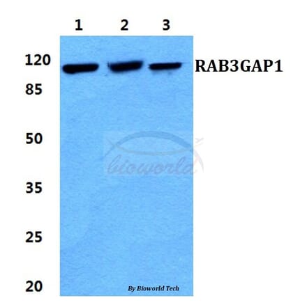 Anti-RAB3GAP1 Antibody from Bioworld Technology (BS5874) - Antibodies.com