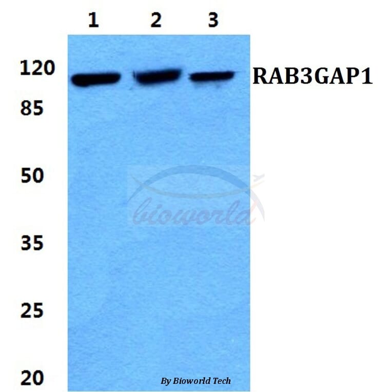 Anti-RAB3GAP1 Antibody from Bioworld Technology (BS5874) - Antibodies.com