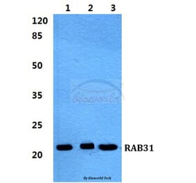 Anti-RAB31 Antibody from Bioworld Technology (BS5875) - Antibodies.com