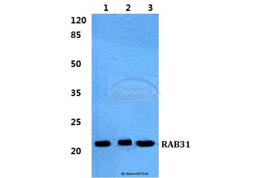 Anti-RAB31 Antibody from Bioworld Technology (BS5875) - Antibodies.com