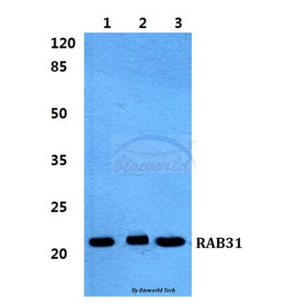 Anti-RAB31 Antibody from Bioworld Technology (BS5875) - Antibodies.com