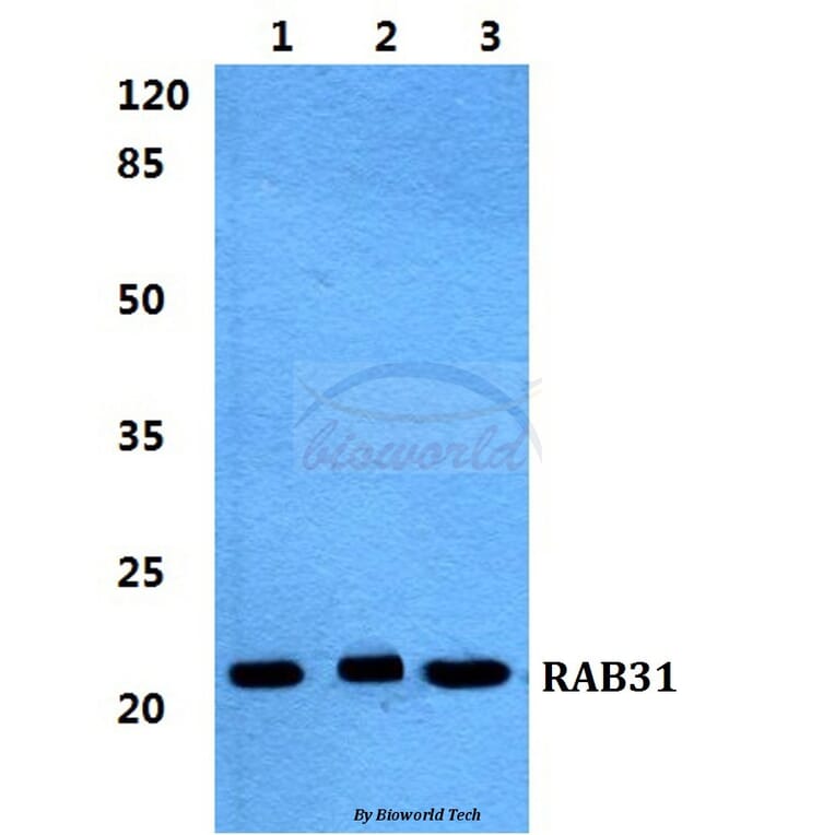 Anti-RAB31 Antibody from Bioworld Technology (BS5875) - Antibodies.com