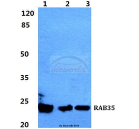 Anti-RAB35 Antibody from Bioworld Technology (BS5877) - Antibodies.com