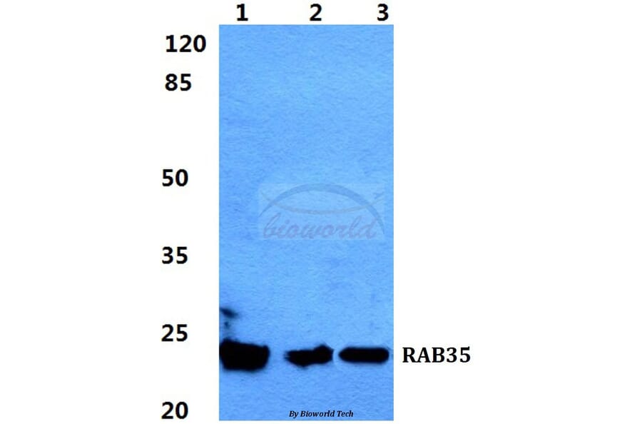 Anti-RAB35 Antibody from Bioworld Technology (BS5877) - Antibodies.com