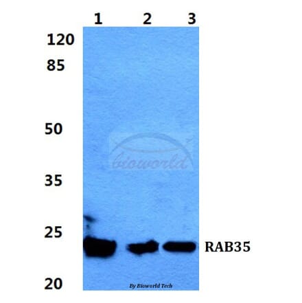 Anti-RAB35 Antibody from Bioworld Technology (BS5877) - Antibodies.com