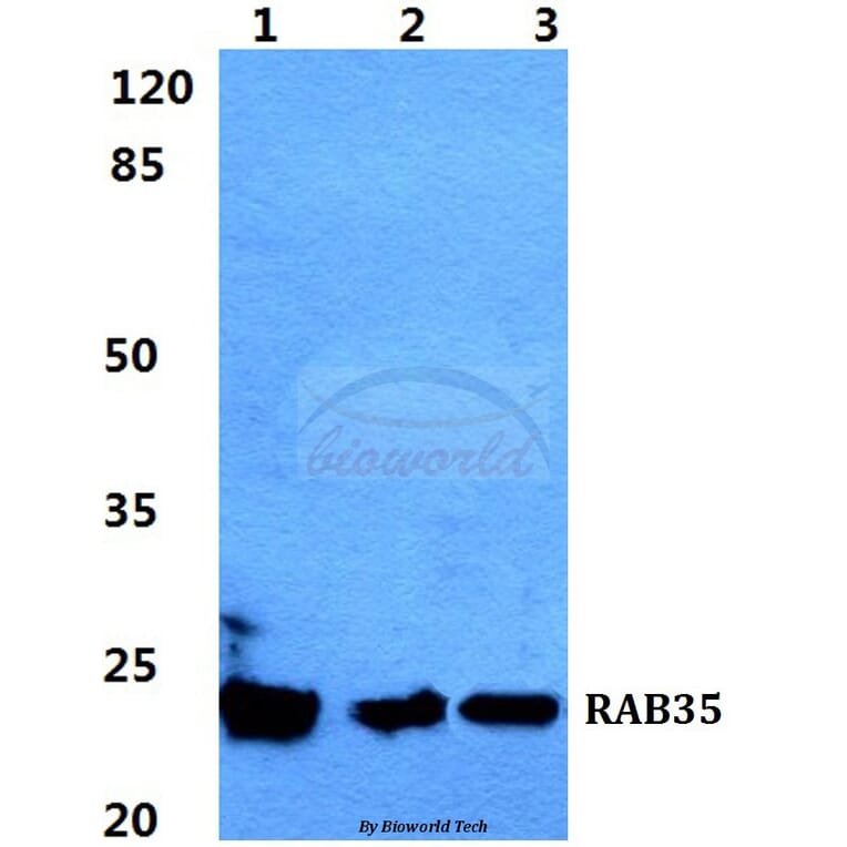 Anti-RAB35 Antibody from Bioworld Technology (BS5877) - Antibodies.com