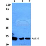 Anti-RAB35 Antibody from Bioworld Technology (BS5877) - Antibodies.com