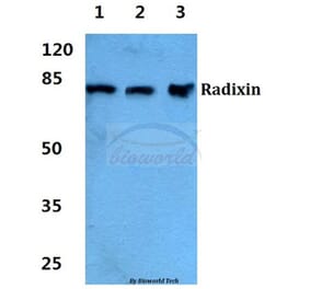 Anti-Radixin Antibody from Bioworld Technology (BS5880) - Antibodies.com