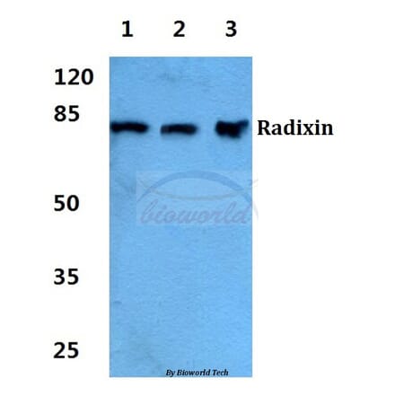 Anti-Radixin Antibody from Bioworld Technology (BS5880) - Antibodies.com