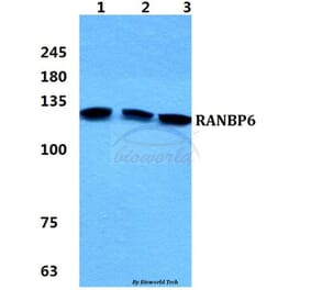 Anti-RANBP6 Antibody from Bioworld Technology (BS5882) - Antibodies.com