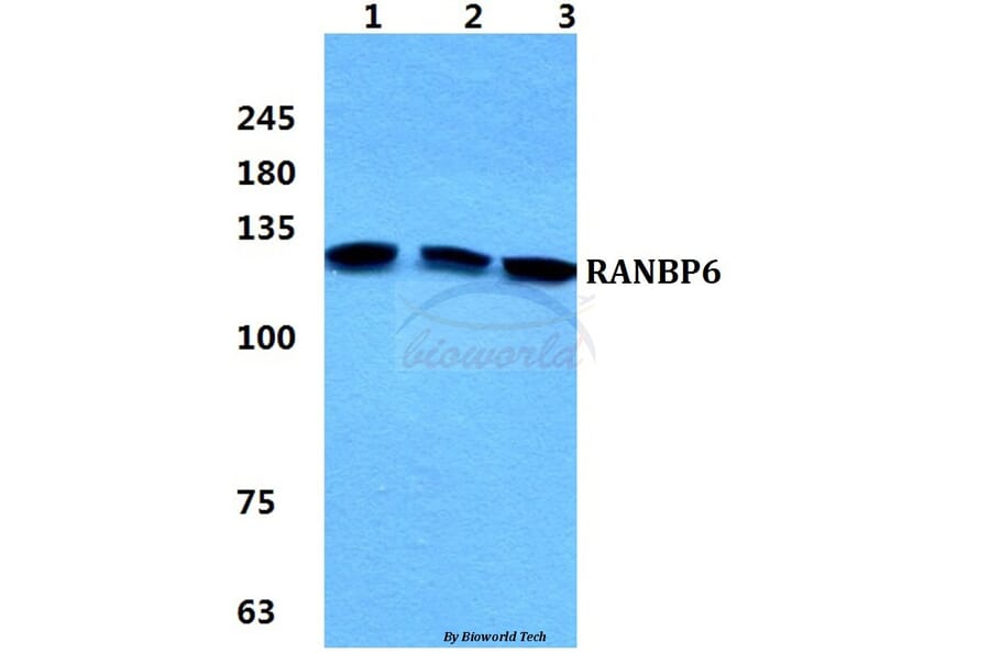 Anti-RANBP6 Antibody from Bioworld Technology (BS5882) - Antibodies.com