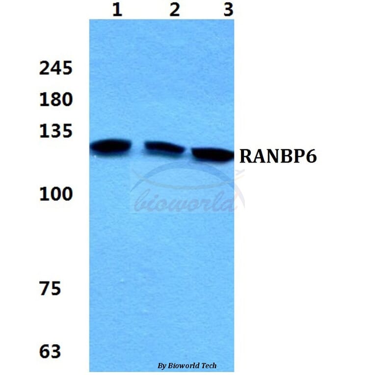 Anti-RANBP6 Antibody from Bioworld Technology (BS5882) - Antibodies.com
