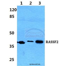 Anti-RASSF2 Antibody from Bioworld Technology (BS5884) - Antibodies.com
